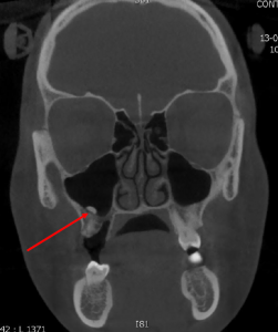 Stoma EDU J 2019, Vol 6, Issue 2, p81-150 – STOMATOLOGY EDU JOURNAL